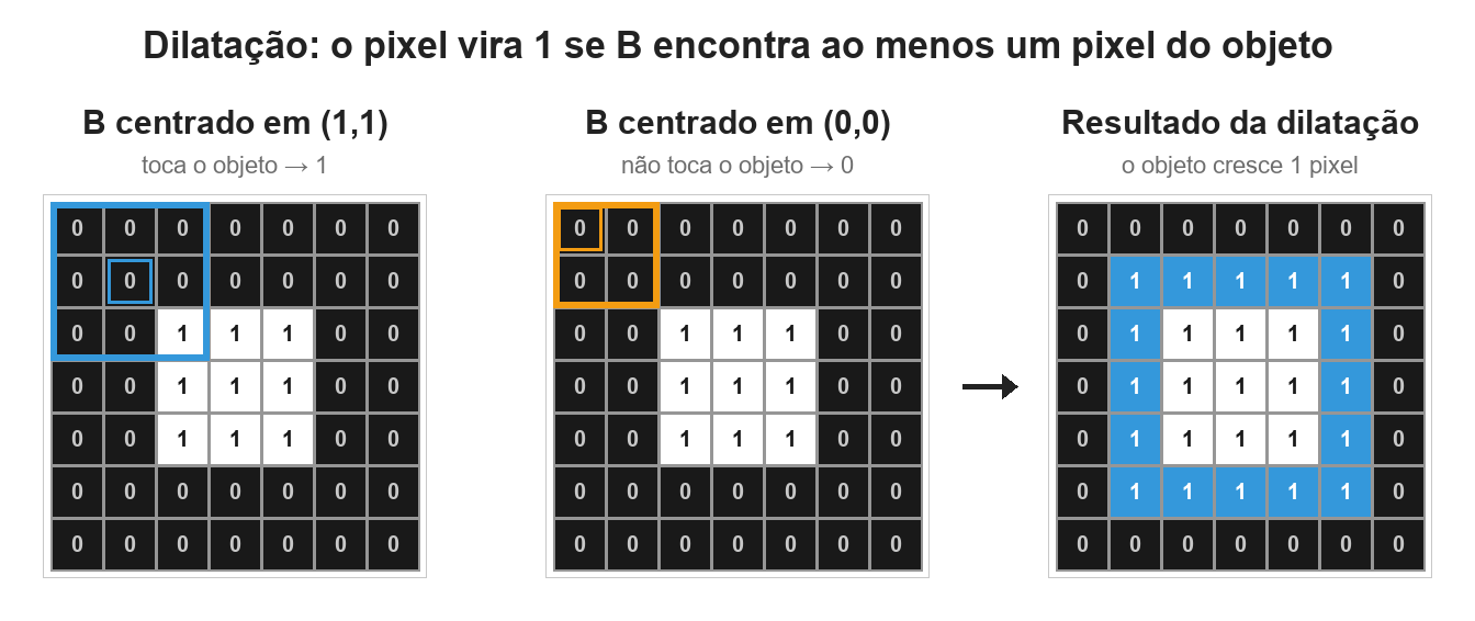 Grade 7x7 com um quadrado 3x3 de uns no centro; o elemento estruturante em azul centrado em (1,1) toca o canto do objeto; em laranja, centrado em (0,0), não toca; o resultado mostra o objeto crescido para 5x5, com o anel novo em azul
